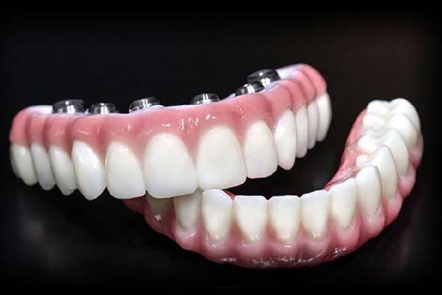 Park Slope Dental Aesthetics | Ceramic Crowns, Oral Exams and Periodontal Treatment