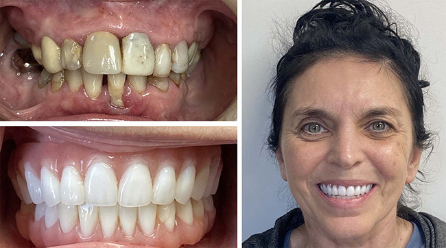 Park Slope Dental Aesthetics | Emergency Treatment, Extractions and Implant Dentistry