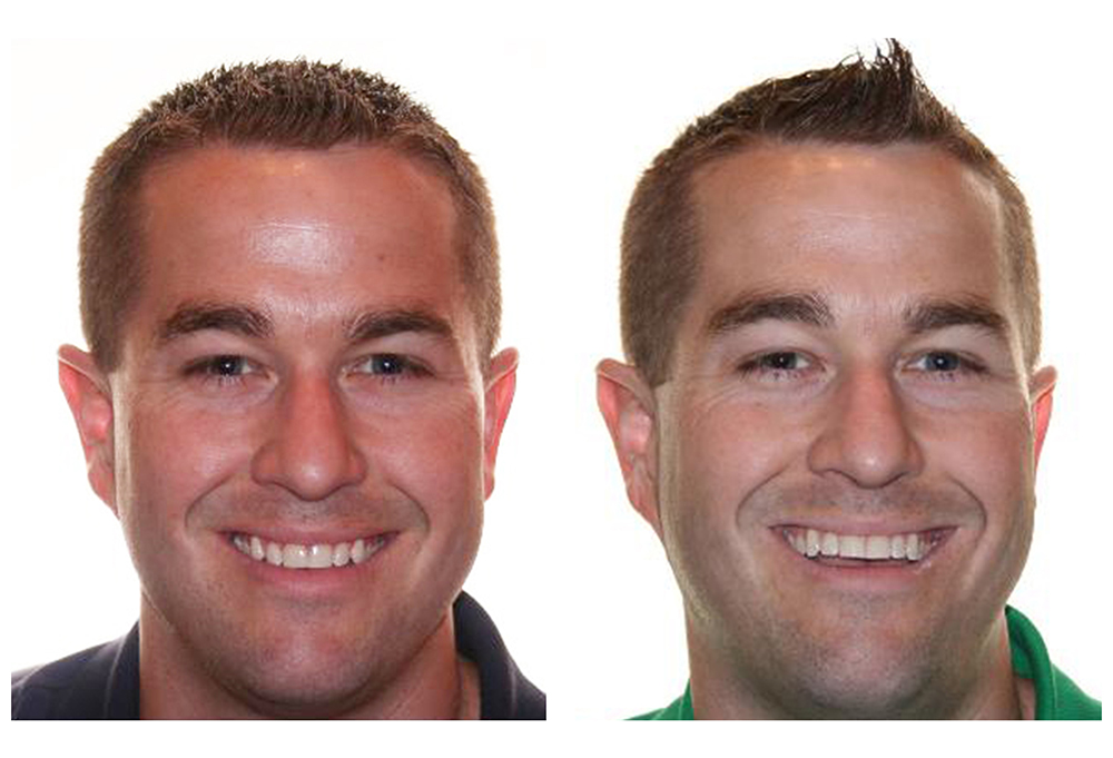 Park Slope Dental Aesthetics