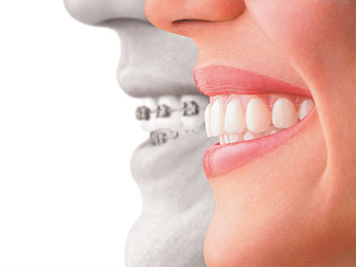 Park Slope Dental Aesthetics | Dental Fillings, Invisalign reg  and Root Canals
