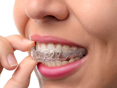 Park Slope Dental Aesthetics | Oral Exams, Dentures and Ceramic Crowns