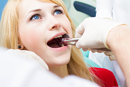 Park Slope Dental Aesthetics | Root Canals, Dental Fillings and Veneers